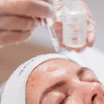 Kit Limpeza de Pele Acneica - Imagem 3