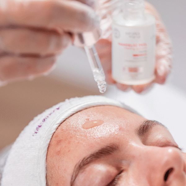 Kit Limpeza de Pele Acneica - Imagem 3