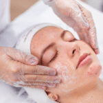 Kit Limpeza de Pele Acneica - Imagem 4